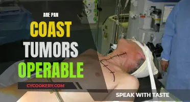Pan Coast Tumors: Operable or Not?