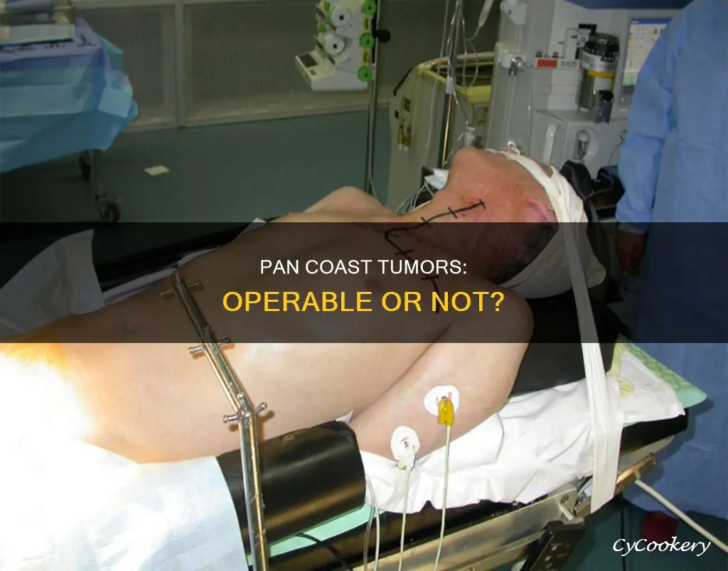 are pan coast tumors operable