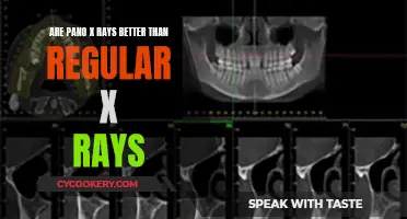 Pano X-Rays: Superior to Regular X-Rays?