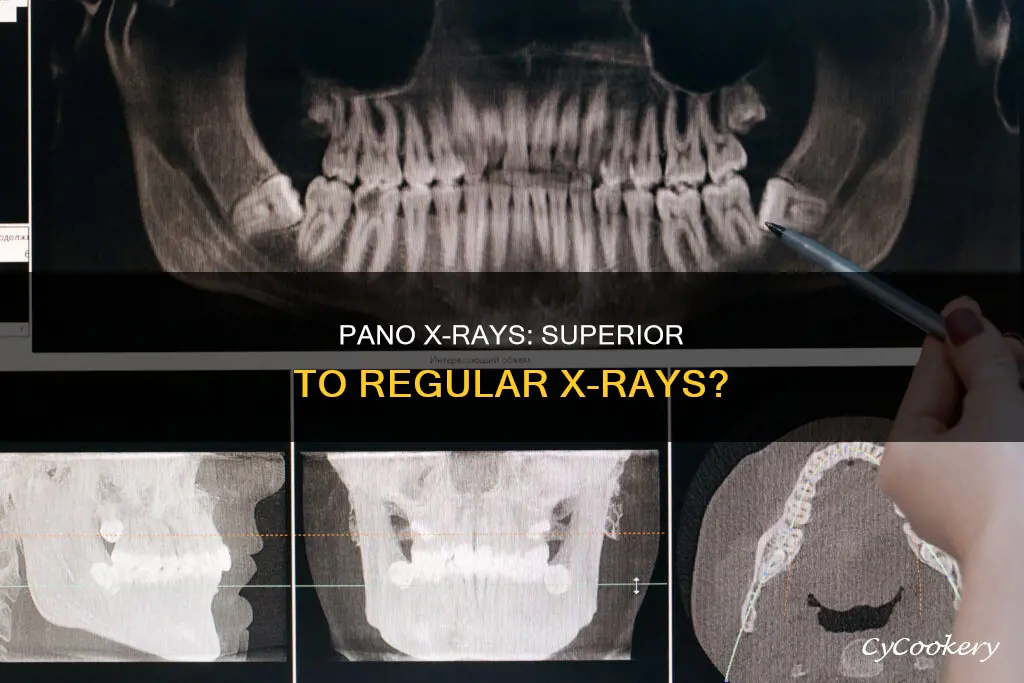 are pano x rays better than regular x rays