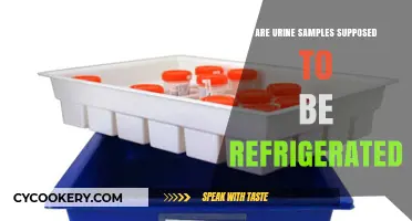 Should Urine Samples Be Refrigerated? Essential Storage Tips Explained