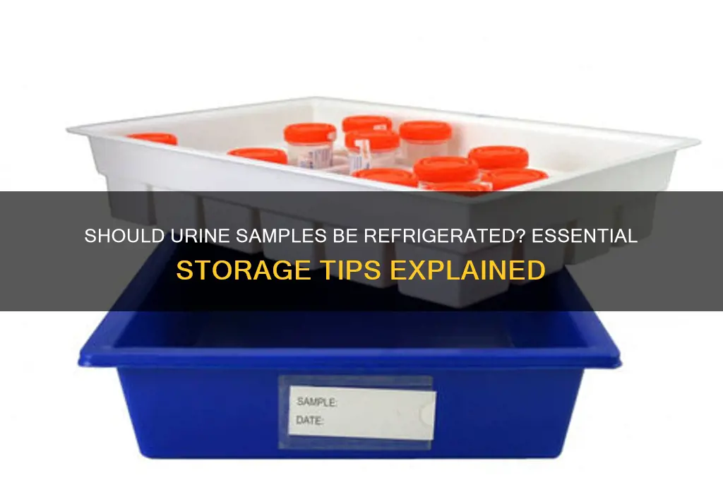 are urine samples supposed to be refrigerated