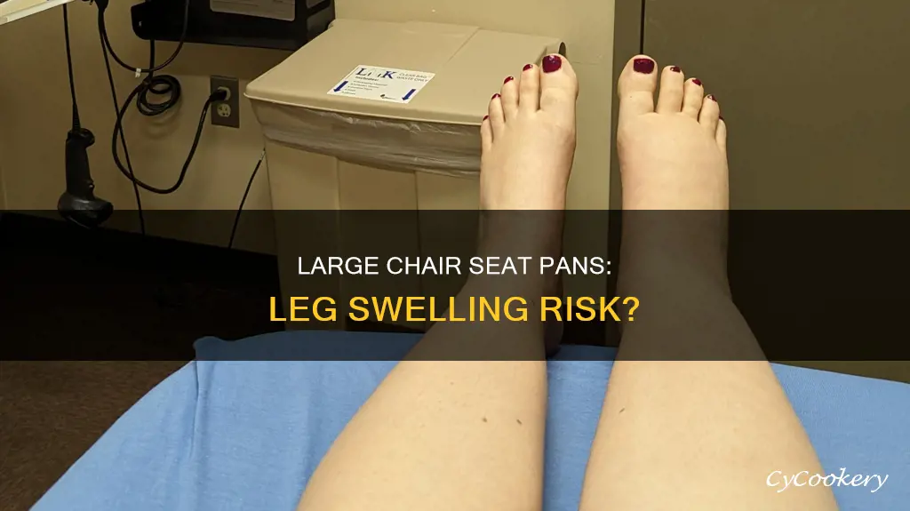 can a large chair seat pan cause leg swelling