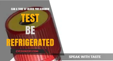 Refrigerating Blood Samples: Albumin Test Tube Storage Guidelines Explained