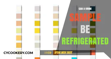 Refrigerating Urine Samples: Best Practices for Accurate Test Results