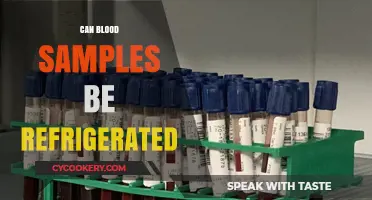 Refrigerating Blood Samples: Best Practices for Preservation and Accuracy