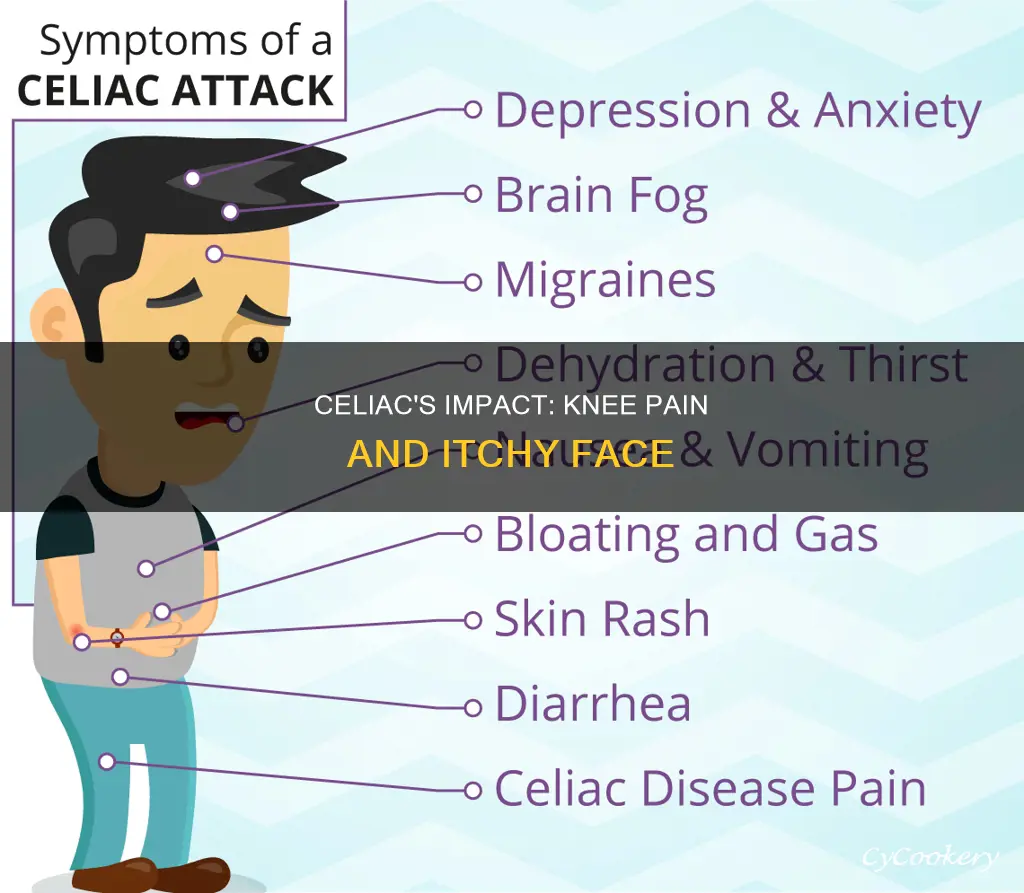 can celiac cause knee pan or your face to itch