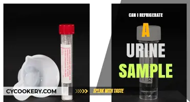 Refrigerating Urine Samples: Best Practices and Safety Tips