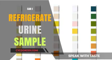 Refrigerating Urine Samples: Best Practices and Safety Tips
