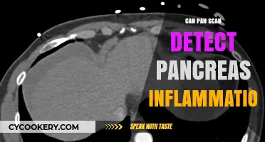 Pancreas Inflammation: Can a Pan Scan Help?