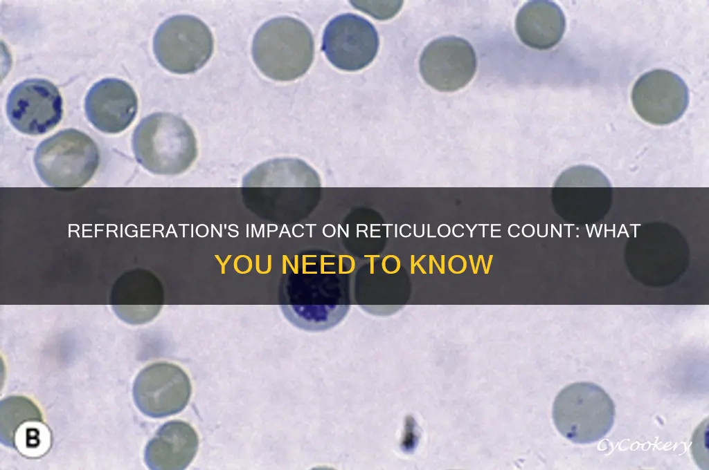 can refrigeration affect reticulocyte count