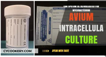 Refrigerating Sputum for Mycobacterium Avium Intracellulare Culture: Best Practices
