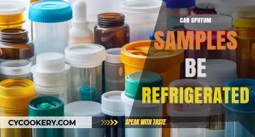 Refrigerating Sputum Samples: Best Practices for Preservation and Testing