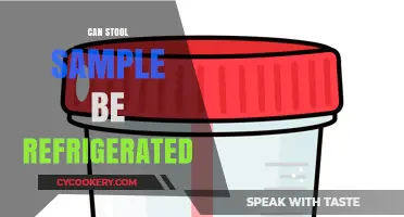 Refrigerating Stool Samples: Best Practices for Accurate Test Results