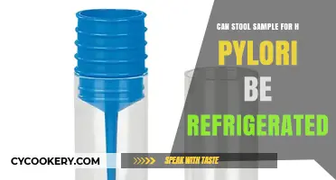 Refrigerating Stool Samples for H. Pylori Testing: Best Practices