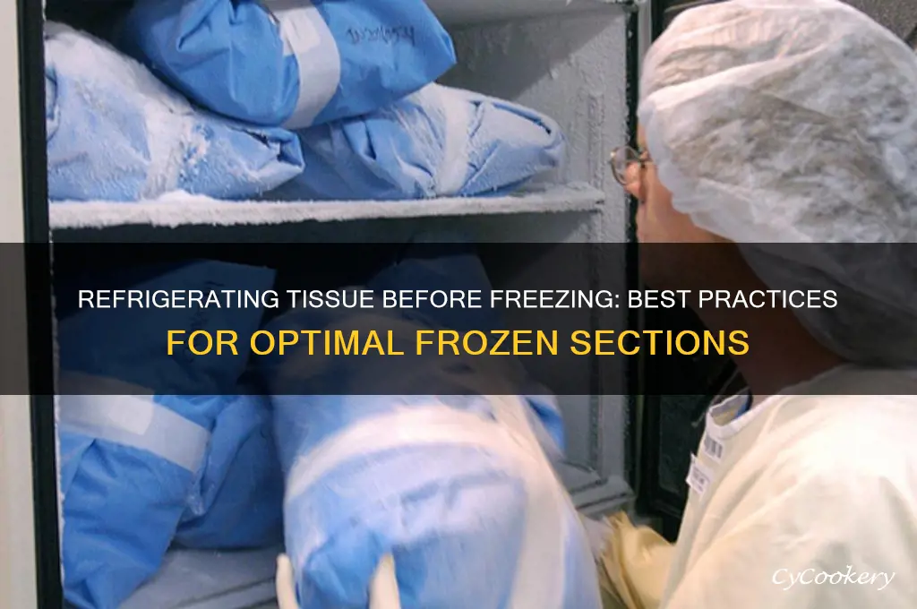 can tissue be refrigerated before frozen sections are made