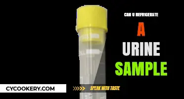 Refrigerating Urine Samples: Best Practices for Accurate Test Results