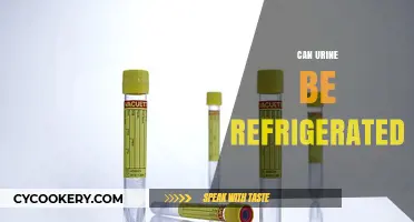 Can You Refrigerate Urine? Storage Tips and Safety Explained