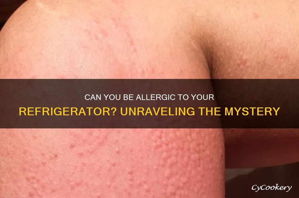 can you be allergic to the refrigerator