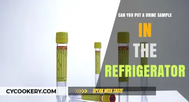 Can You Refrigerate Urine Samples? Proper Storage Tips Explained
