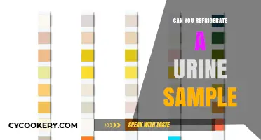 Refrigerating Urine Samples: Best Practices and Safety Tips