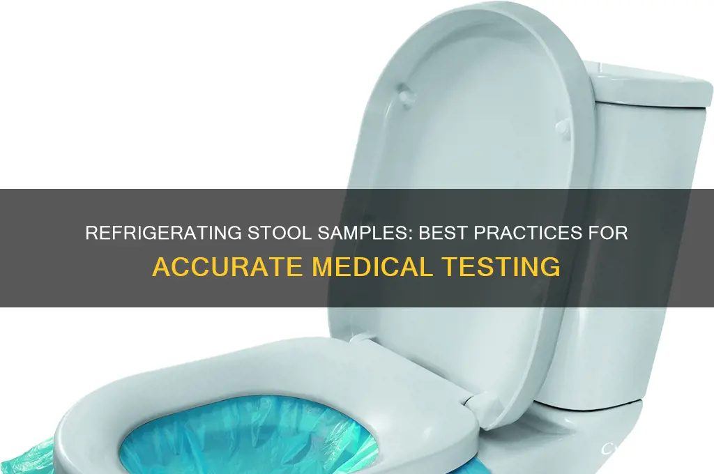 can you refrigerate stool sample