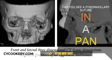 Zygomaxillary Suture: The Pan's Secret Feature