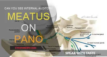 Pano X-Rays: Visualizing the Internal Auditory Meatus