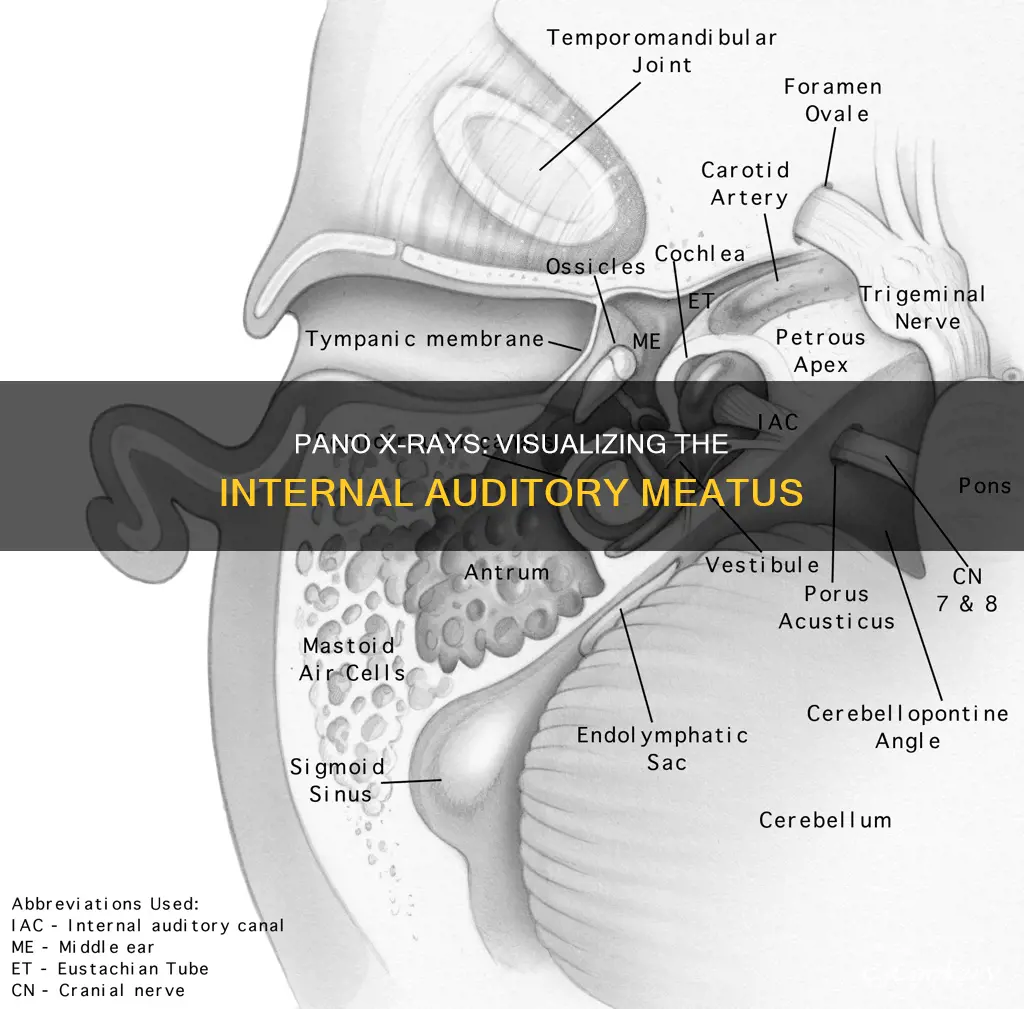 can you see internal auditory meatus on pano