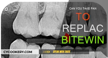 Panoramic X-rays: A Viable Alternative to Bitewing X-rays?