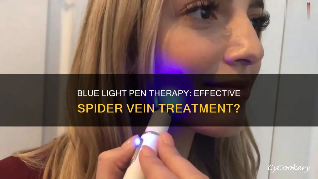 do blue light pans actually work to remove spider veins