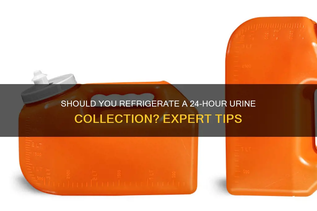 do i have to refrigerate 24 hour urine collection