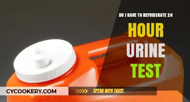 Refrigerating 24-Hour Urine Tests: Essential Tips for Accurate Results
