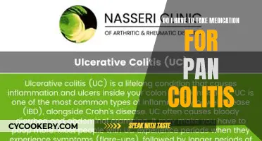 Colitis Medication: Should You Take It?