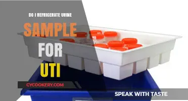 Should You Refrigerate Urine Samples for UTI Testing? Quick Guide