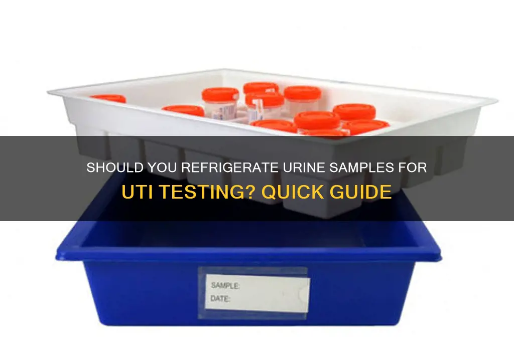 do i refrigerate urine sample for uti