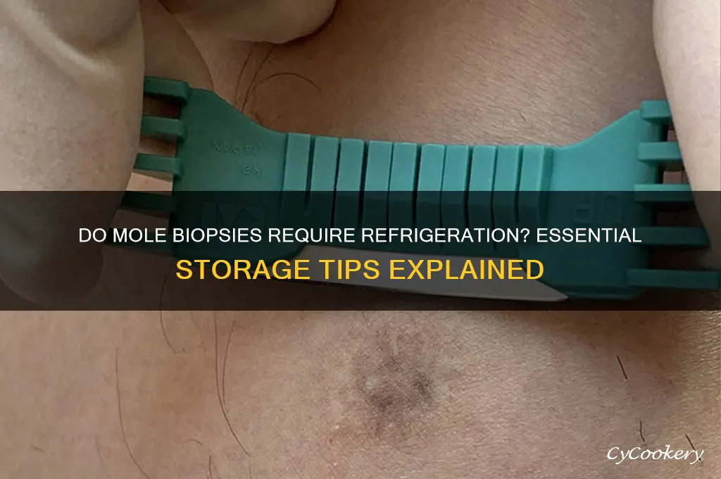 do mole biopsies have to be refrigerated
