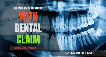 Dental X-ray Claims: Do Panos Need to Be Sent?