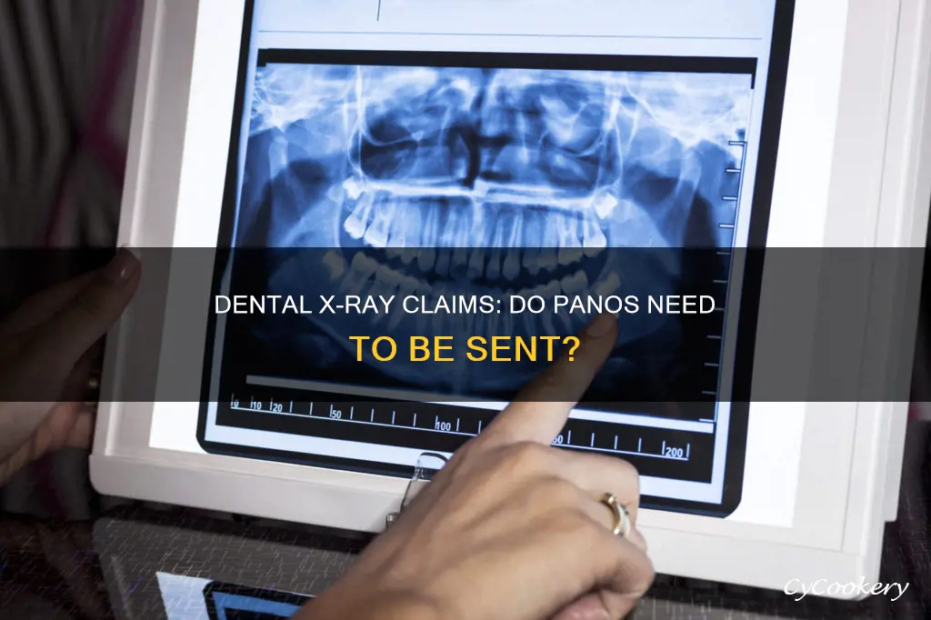 do pano xrays get sent in with dental claim