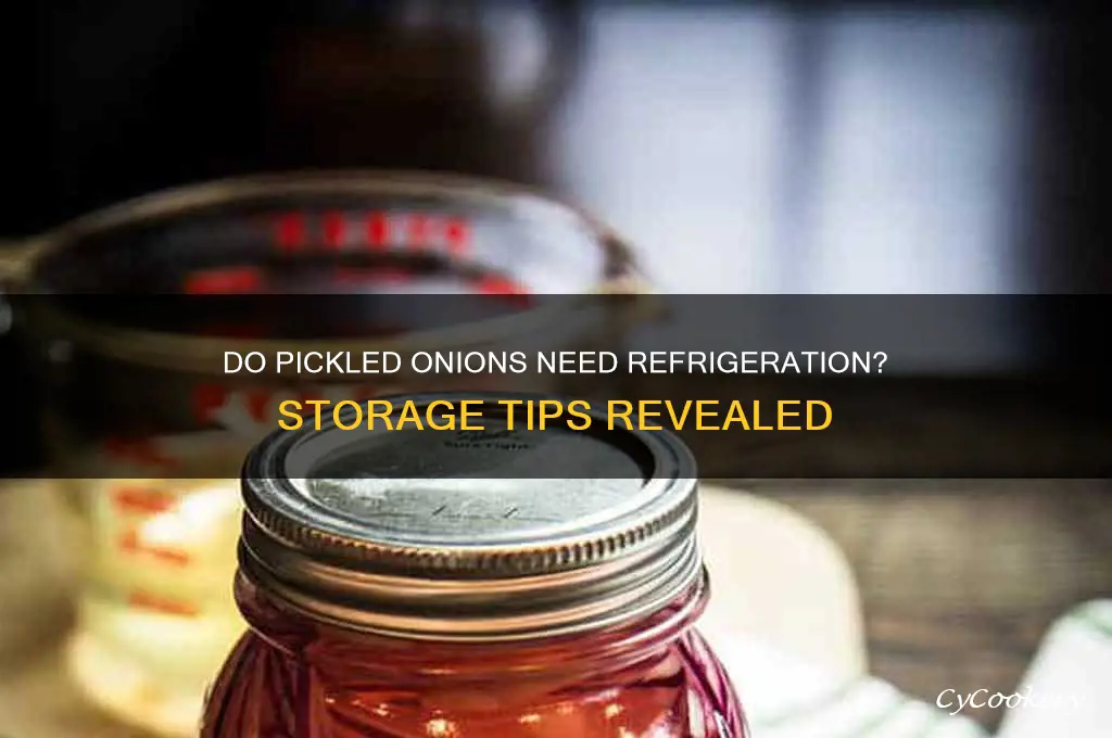 do pickled onions have to be refrigerated