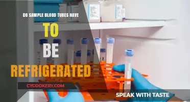 Refrigerating Sample Blood Tubes: Essential or Optional? Expert Insights