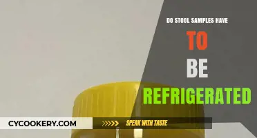 Should You Refrigerate Stool Samples? Essential Tips for Proper Handling