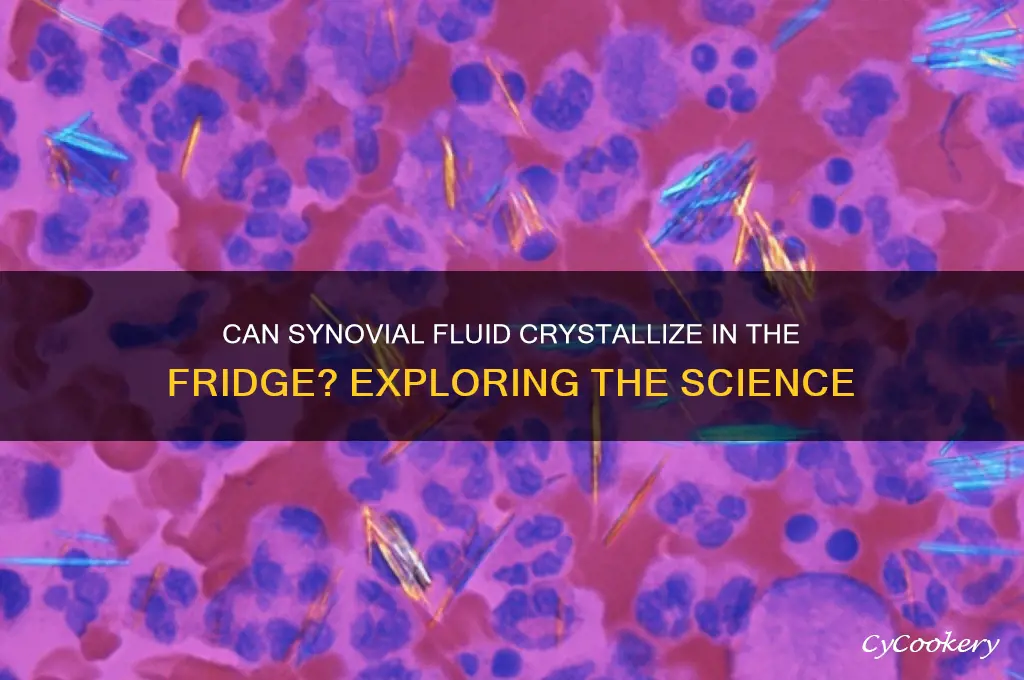 do synovial develop crystals when sitting in the refrigerator
