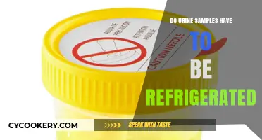 Should You Refrigerate Urine Samples? Storage Tips and Best Practices