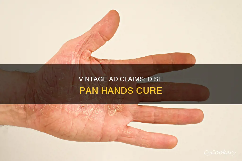do you have dish pan hands vintage ad
