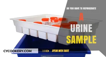 Urine Sample Storage: Refrigeration Required or Room Temp Okay?
