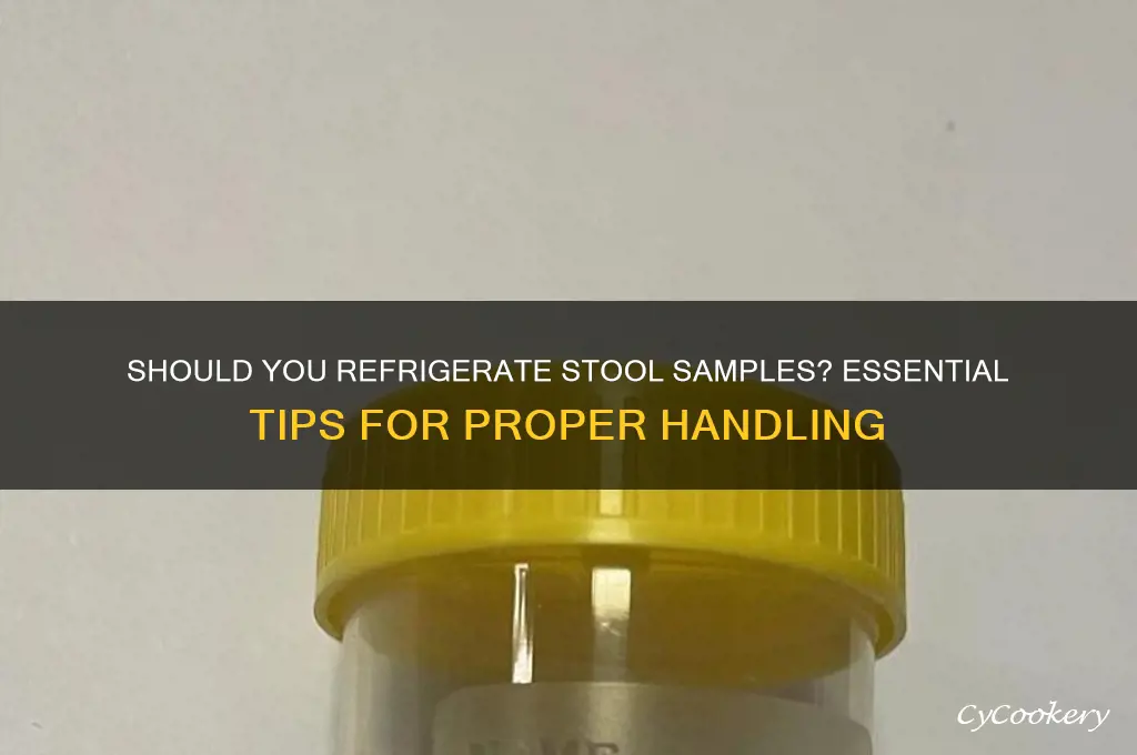 do you have to refrigerate stool sample