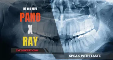 Pano X-Ray: When and Why?