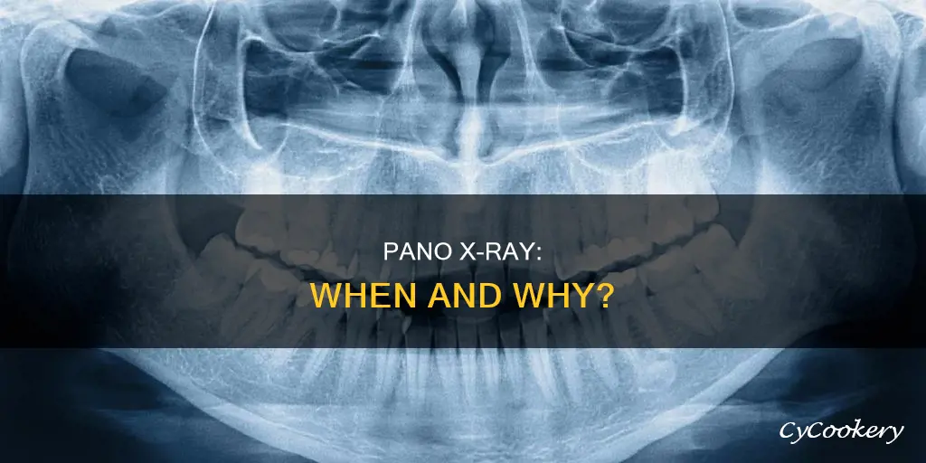 do you need pano x ray