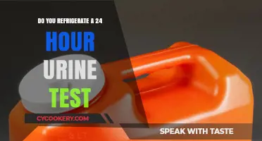 Should You Refrigerate a 24-Hour Urine Test? Expert Tips